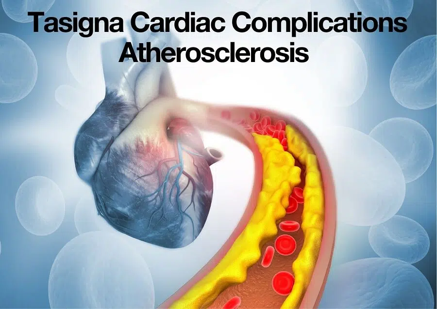Tasigna Cardiac Complications