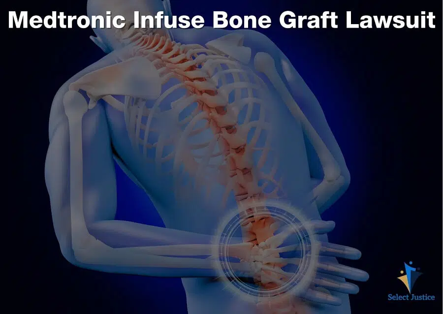 Medtronic Infuse Bone Graft Lawsuit