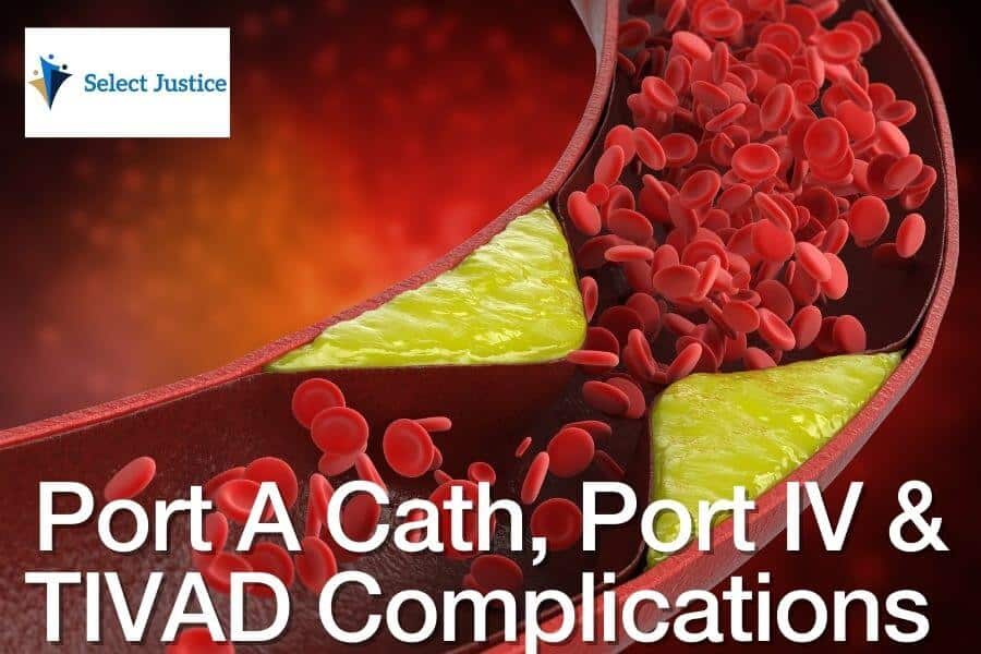 Port A Cath Port IV TIVAD Complications